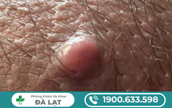 Hình ảnh minh họa